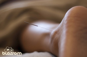 acupuncture portland oregon